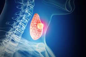 Thyroid Diagnosis AI